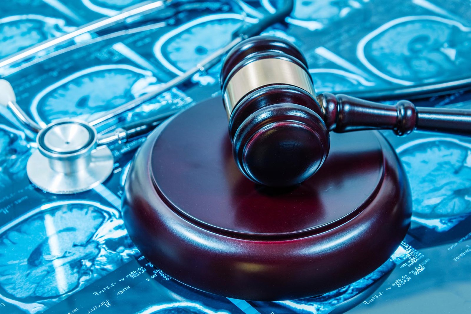 O perito pode negar o benefício previdenciário mesmo com laudos/relatórios de outros médicos?